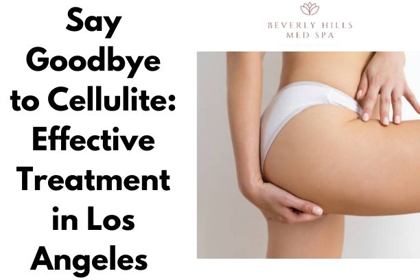 Say Goodbye to Cellulite: Effective Treatment in Los Angeles