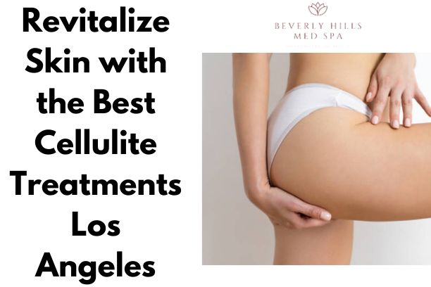 Revitalize Skin with the Best Cellulite Treatments Los Angeles