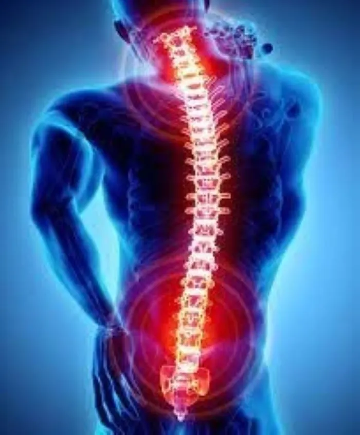 The most effective pain reliever for severe back pain