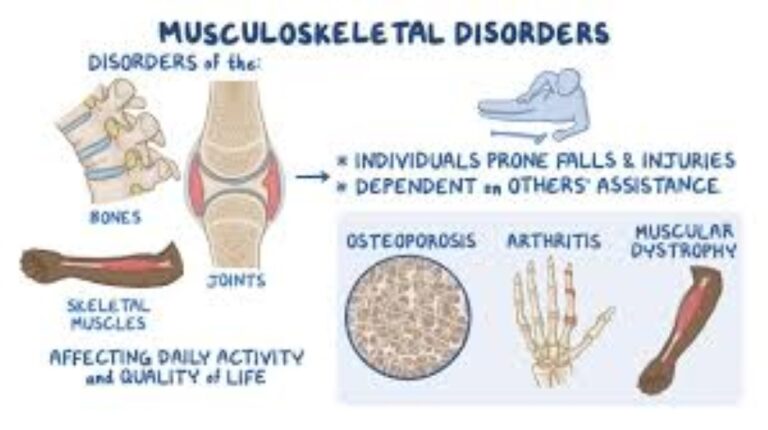 Musculoskeletal Disorders