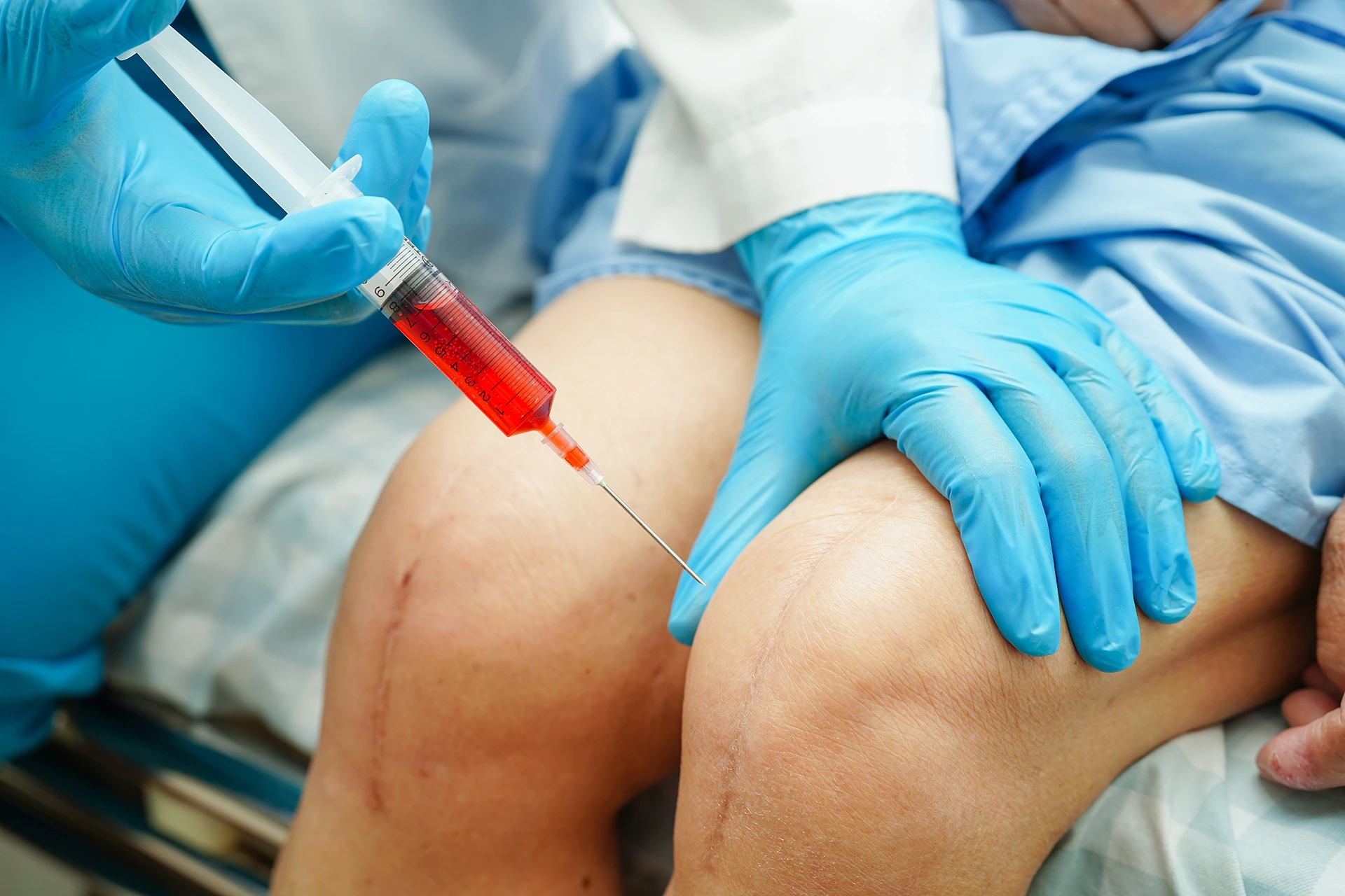 How Cortisone Shots Help Manage Chronic Pain in San Antonio