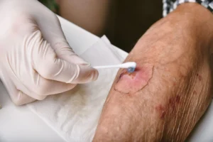 wound care center