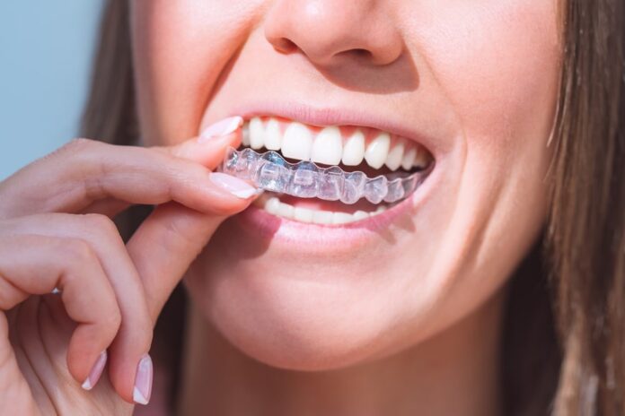 invisalign cardiff