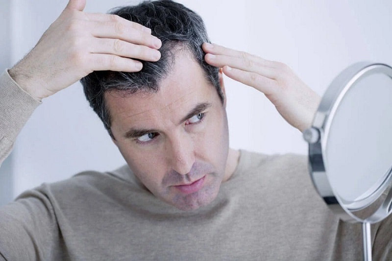 baldness treatment baldness treatment