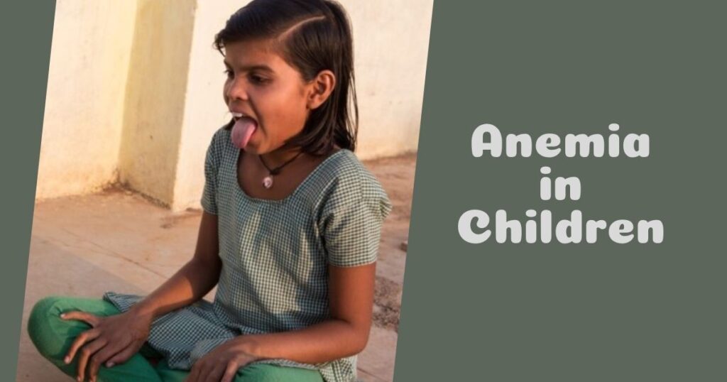 Causes of Anemia in Children