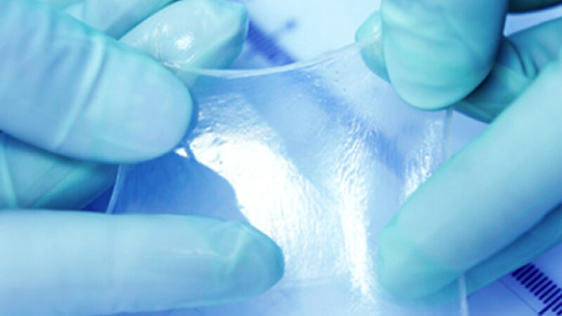 Why Amniotic Wound Grafts Are Changing Advanced Wound Care