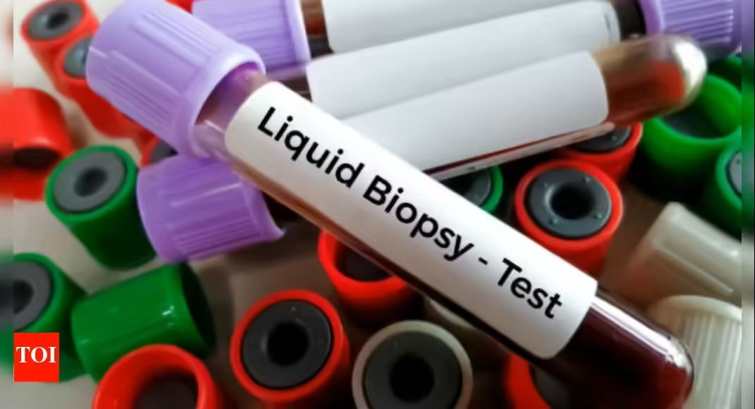 Liquid Biopsy Test: A Less Invasive Approach to Cancer Detection and Monitoring